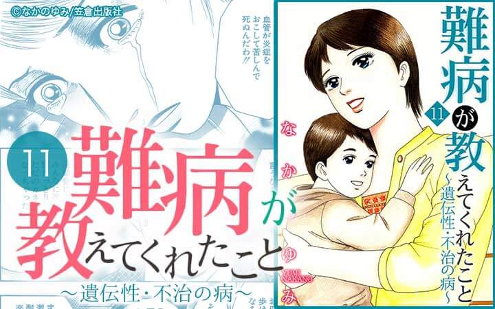 難病が教えてくれたこと11～遺伝性・不治の病～